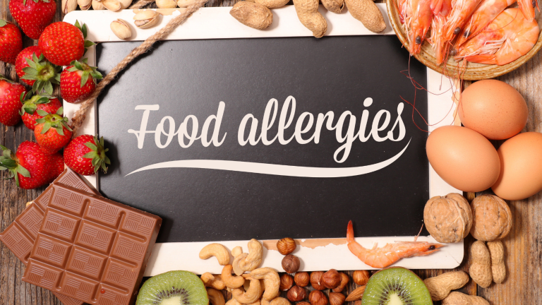 Navigating Celebrations With Food Allergies
