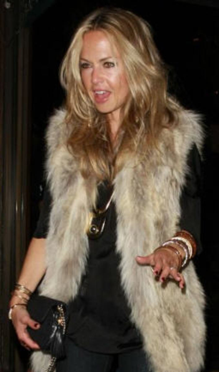 Rachel-Zoe-Fur-Vest